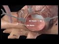 Cox-Maze IV Procedure Animation for Surgical Ablation