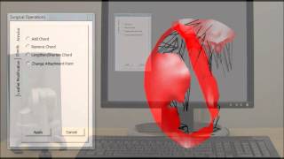 Interactive, Patient-Specific Simulation of Mitral Valve Repair