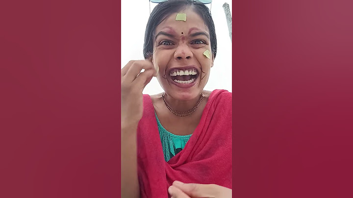 Cringe or not what eyball 😲😃🤪😁👁️🍎🍒🍓#funny#comedy#shortvideos