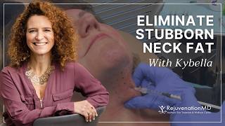 The Treatment That Eliminates Stubborn Neck Fat Without Surgery | Kybella®