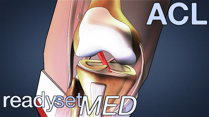 What is the ACL and How Does it Work? - ACL Series