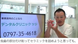 綺麗な歯になるセラミックが出来る人、出来ない人　神戸・芦屋の歯医者　デンタルクリニックツジ