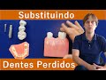 Substituindo Dentes Perdidos: Implante Dentário, Coroa Dental, Pivô [Parte 1] -  Qual a Diferença?