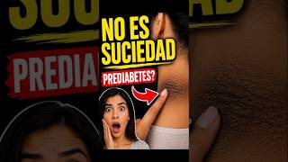 ¿Tienes ESTA mancha en el cuello? ⚠️ No es suciedad