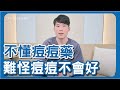 擦遍青春痘治療用藥還是治不好？！口服抗生素有效嗎？有沒有副作用？