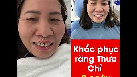 Khắc Phục Răng Thưa và Hô - Nha Khoa Biên Hòa