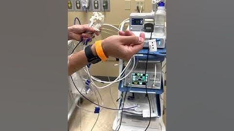 Spyglass Choledochoscope