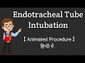 Endotracheal Tube Intubation || Animated Procedure || Hindi