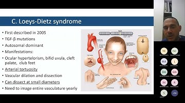 CLICC Day 4: Surgical management of aortopathy