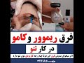 فرق ریموور و کامو در کار تاتو فرق ریموور و کامو در کار تاتو