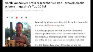 Using SPECT brain imaging to find brain dysfunction, with Rob Tarzwell