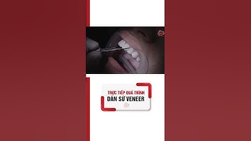 Cận Cảnh Quá Trình Dán Sứ Veneer Răng #shorts