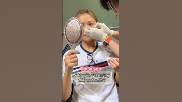 Tại vì sao xỏ khuyên cánh mũi lại chảy nước mắt? TinyBox chia sẻ