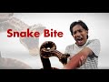 Snakebite Emergency: A–Z Life-Saving Response Everyone Must Know