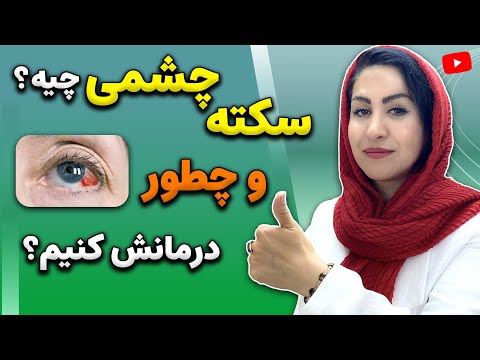 سکته چشمی چیست؟ | علل، روش های پیشگیری و درمان سکته چشم با این راهکارهای طبیعی