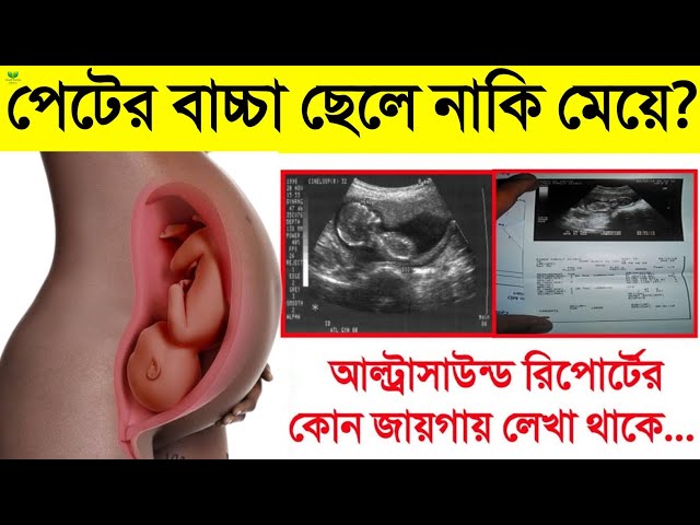 Jamoat avtobusida jinsiy aloqa