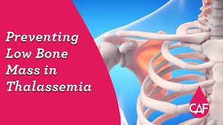 Preventing Low Bone Mass In Thalassemia