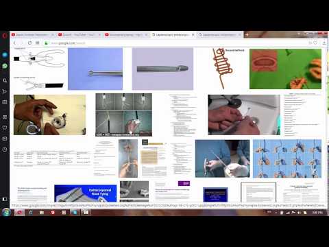 ქირურგიული კვანძები და მარყუჟები - ვიდეო #20