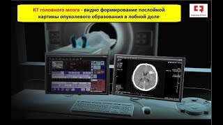 Компьютерная томография (КТ): показания, возможности, принцип работы и виды контрастирования