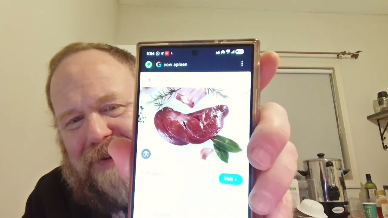 Arukh HaShulchan YD 43.15-17 Supplemental Day 315