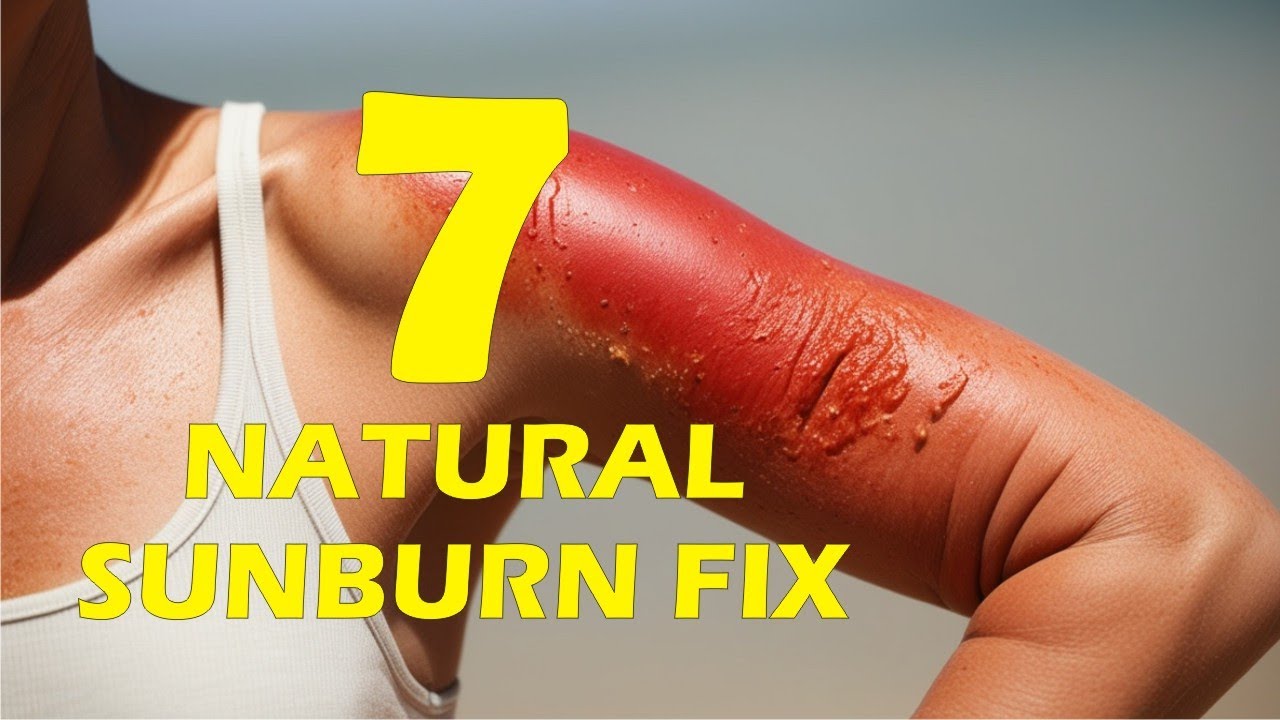 Как лечить солнечные ожоги натуральными средствами? | Эффективные домашние средства
