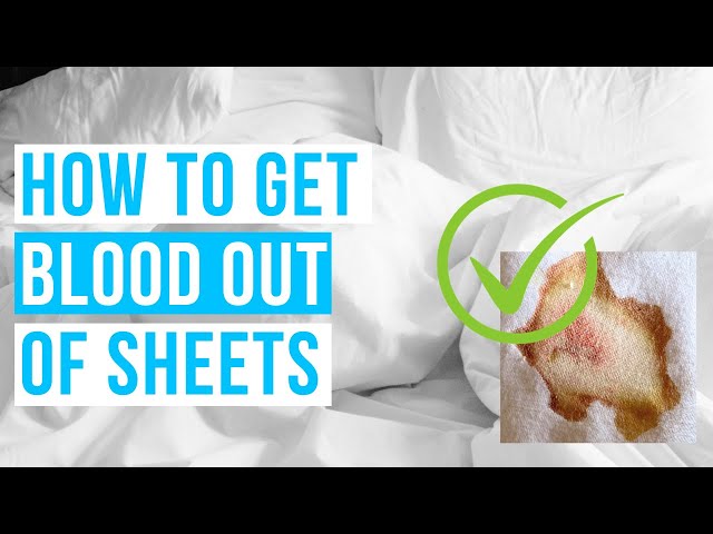 How to GET BLOOD OUT OF SHEETS  Remove dried old blood stains