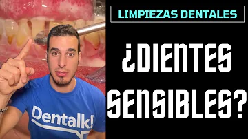 ¿Por qué mis dientes siguen amarillos después de la limpieza?