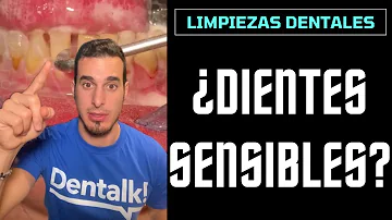 ¿Por qué se sienten los dientes afilados después de una limpieza?