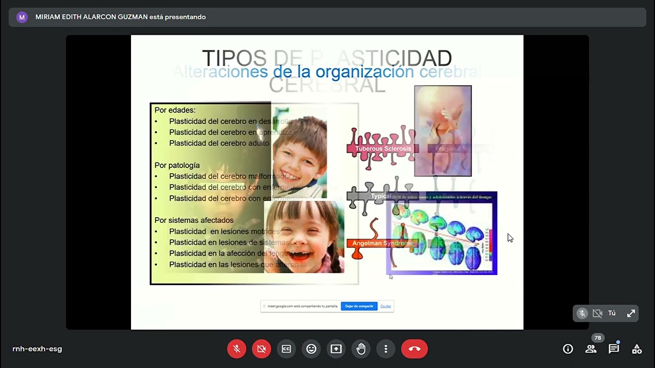 T 33 Desarrollo del niño. Dra. Alarcón , T 34 Alteraciones del Desarrollo. Dra. Alarcón 03 05 2023