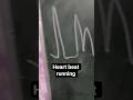 heart drawing #viral #comedy #tripletrouble_555 #funny #shortvideos #funny
