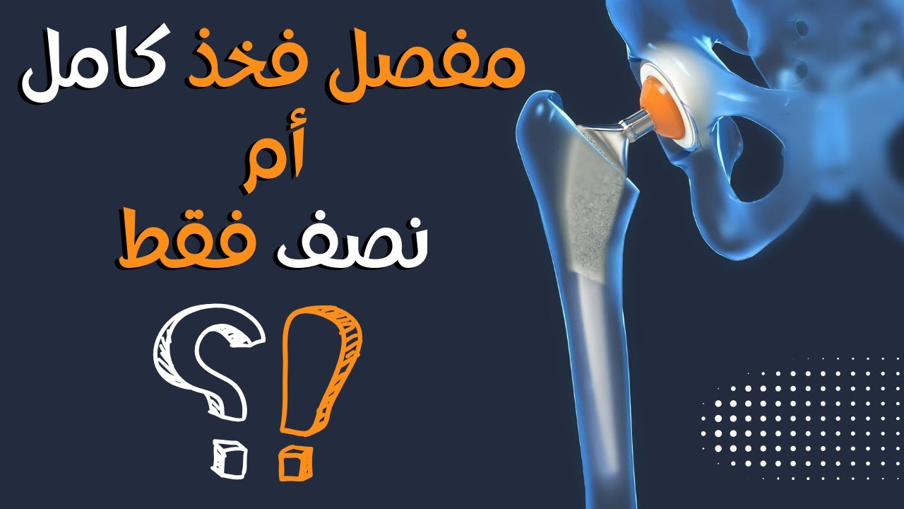 تغيير مفصل فخذ صناعي كامل أم نصف مفصل فقط؟ #تغيير_مفصل_الفخذ