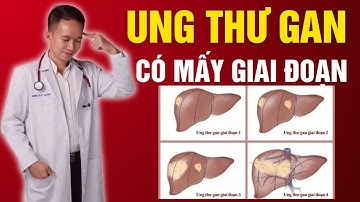 Ung thư gan có mấy giai đoạn  |Dr Trần Nhựt Minh