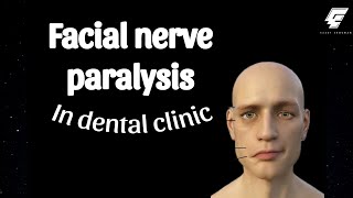 سبب حدوث ال facial nerve paralysis في عيادة الأسنان وكيفية التعامل معاها