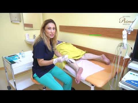 Bel ağrısı, ayağa yayılan ağrılardan əziyyət çəkən pasientimizə nevral blokada etdik!