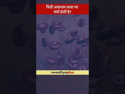 पित्ती अचानक त्वचा पर क्यों होती है? | What are the causes of Hives? | Dr Ruchika Singh | #Shorts