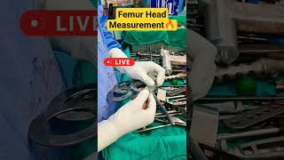 Live 💯 Femur Head Measurement कूल्हे के गोले की नपाई #femur #hipreplacementrecovery #hiparthritis 💥