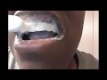 Brushing Teeth With Baking Soda