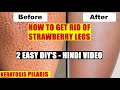 How to Get Rid of Strawberry Legs Fast | Hindi Easy DIY | Wamika Beauty