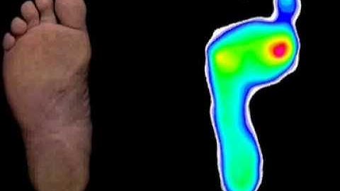 foot pressure (Converted).mov