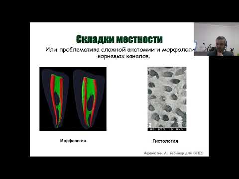 Вебинар №6 - Микробиология корневых каналов. Базовые  знания для успешного принятия решений.