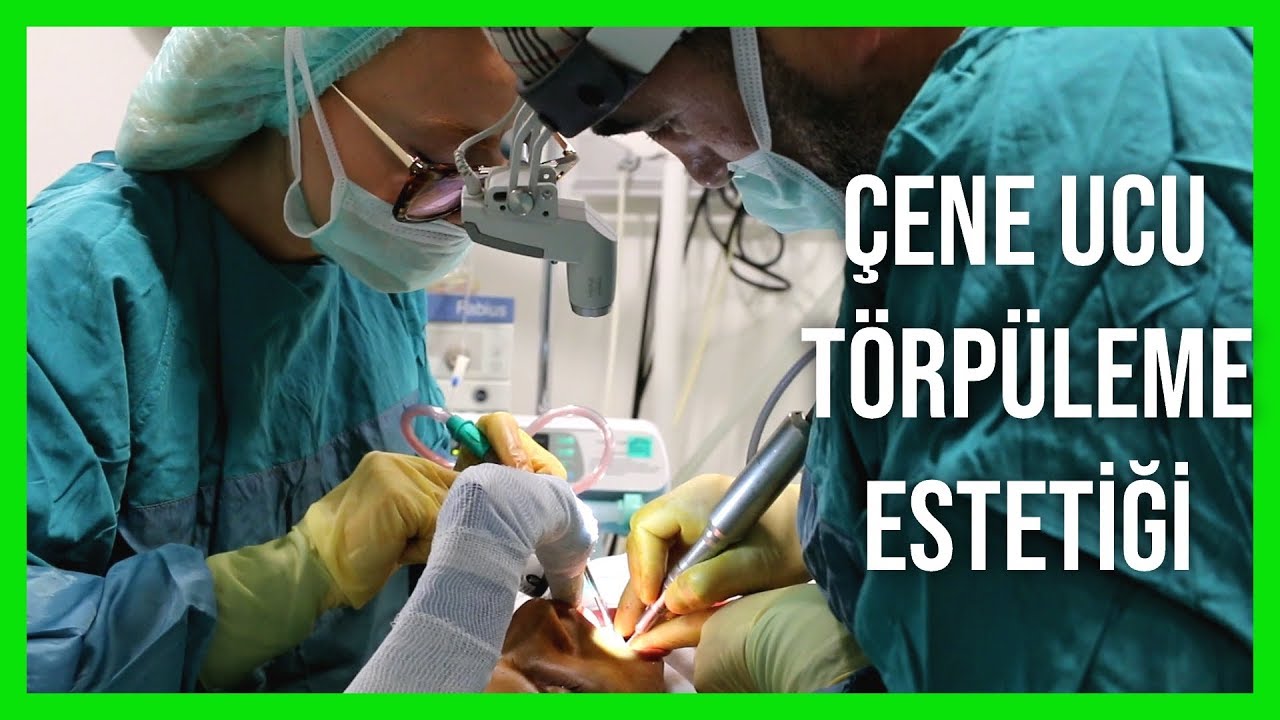 Çene Ucu Törpüleme Estetiği👍🤩🧡