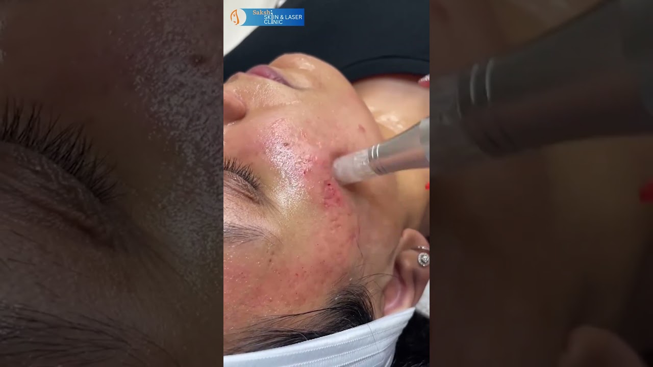 Advanced Care for Your Skin Concerns! ✨