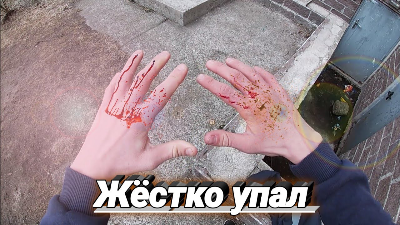 ❌Жёсткий фэил повредил руку ! Не кликбэйт ✅/ Крутой паркур 2022 . Mi gentle remix