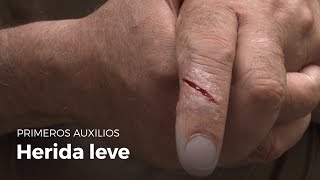 Te en cortas dedo? vena cuando el ¿Qué sucede una