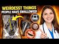 Doctors Reveal the Strangest Things Ever Swallowed (Real Cases!)