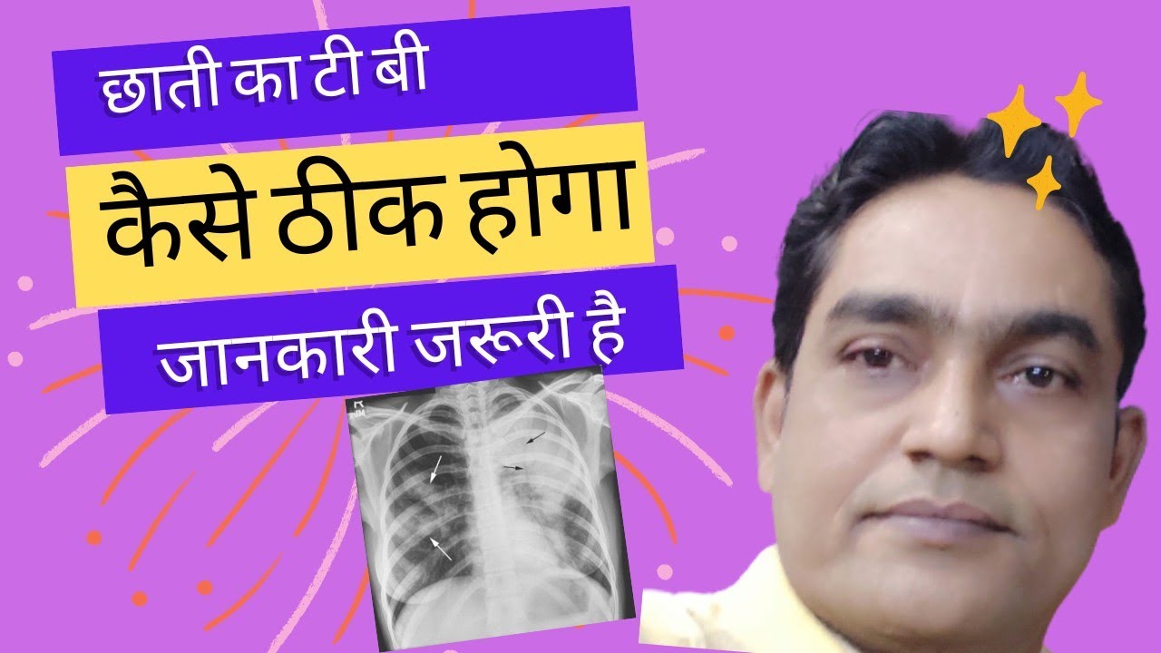 tb ki bimari kaise hoti hai tb ka ilaj tuberculosis treatment in