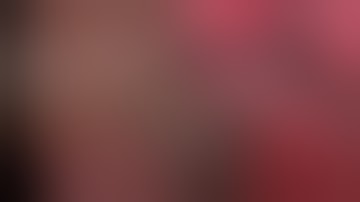 Asvide: Right upper lobe posterior segmentectomy S2