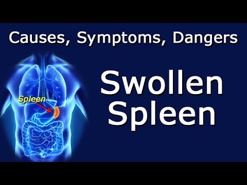 Swollen Spleen - Causes, Symptoms, Dangers - YouTube