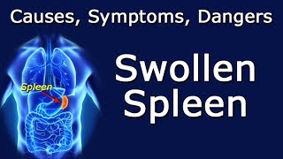 Swollen Spleen - Causes, Symptoms, Dangers