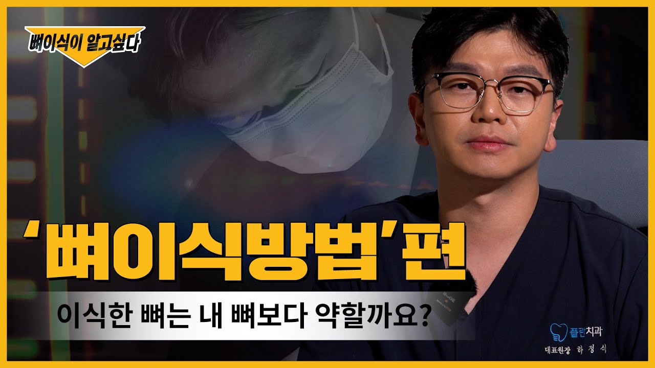 [부산뼈이식임플란트] 임플란트 뼈이식 고민중❓❓  | 수술 방법 쉽게 설명해 드립니다! | 🚨 꼭 확인해보세요 🚨